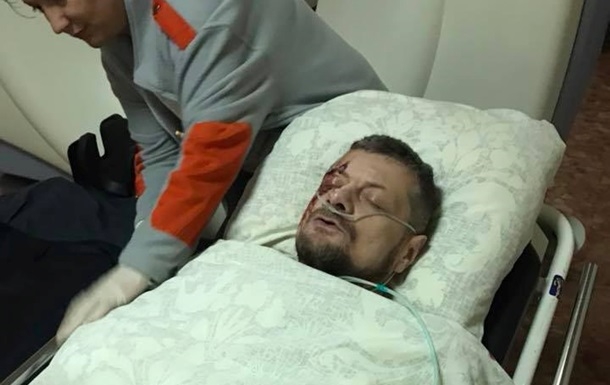 Опубликовано видео момента взрыва во время покушения на "ляшковца" Мосийчука