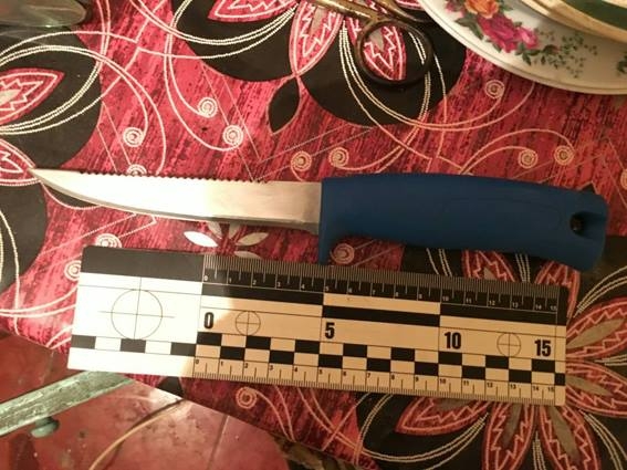 На Николаевщине психически больная девушка ранила ножом продавца