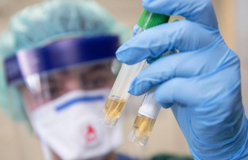 В Эквадоре мужчина заразился двумя разными штаммами коронавируса