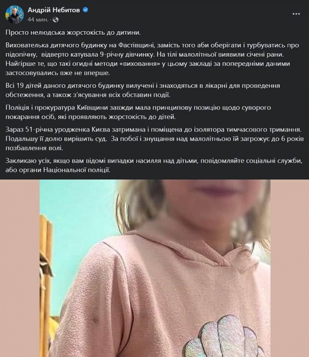 В детдоме Киевской области воспитатель пытала ребенка