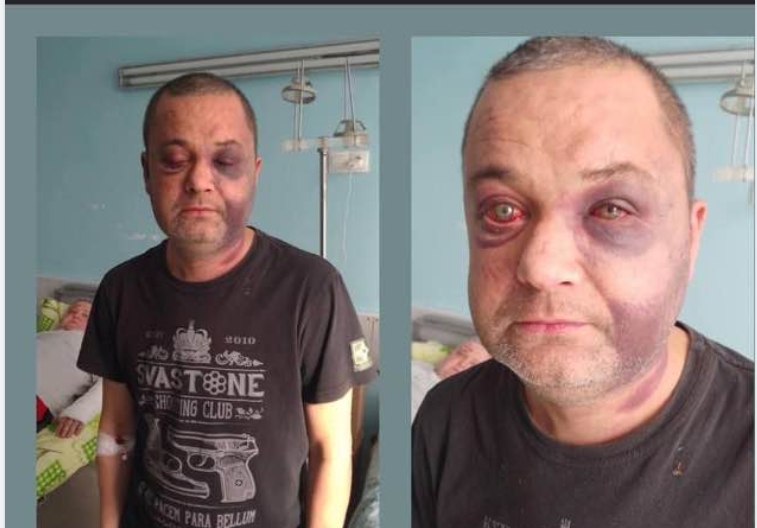 На Миколаївщині поліція перевіряє ймовірний факт побиття жителя у ТЦК
