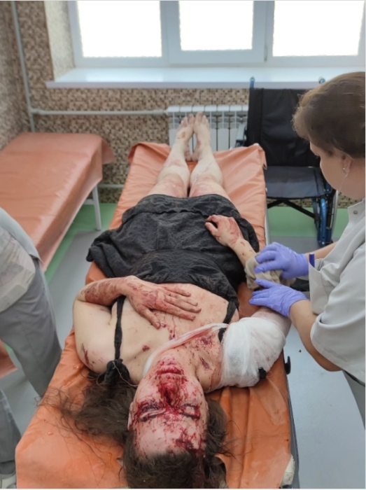 Підприємниця постраждала внаслідок атаки «шахедів» у Миколаєві: відкрито кримінальне провадження Підприємниця постраждала внаслідок атаки «шахедів» у Миколаєві: відкрито кримінальне провадження