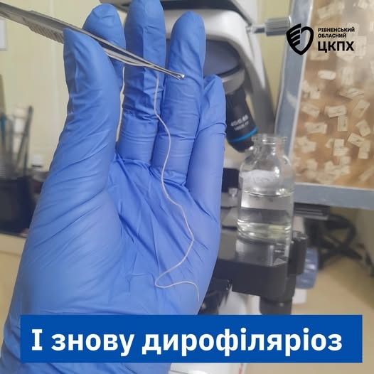 В Украине женщине удалили 11 сантиметрового червя из века: медики предупреждают об опасности В Украине женщине удалили 11 сантиметрового червя из века: медики предупреждают об опасности