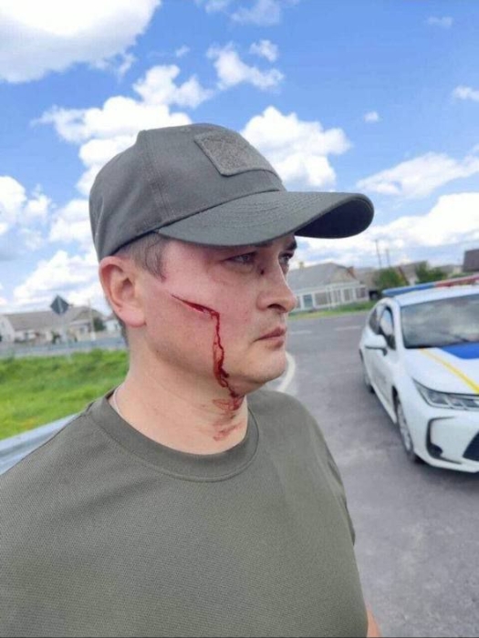 Чоловік із лопатою напав на співробітника ТЦК на Волині Чоловік із лопатою напав на співробітника ТЦК на Волині