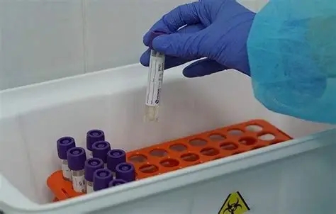В Киеве резко увеличилось количество больных коронавирусом в стационарах В Киеве резко увеличилось количество больных коронавирусом в стационарах