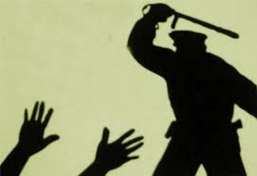 Побили ні за що: суд визнав, що патрульні у Запоріжжі перевищили повноваження Побили ні за що: суд визнав, що патрульні у Запоріжжі перевищили повноваження