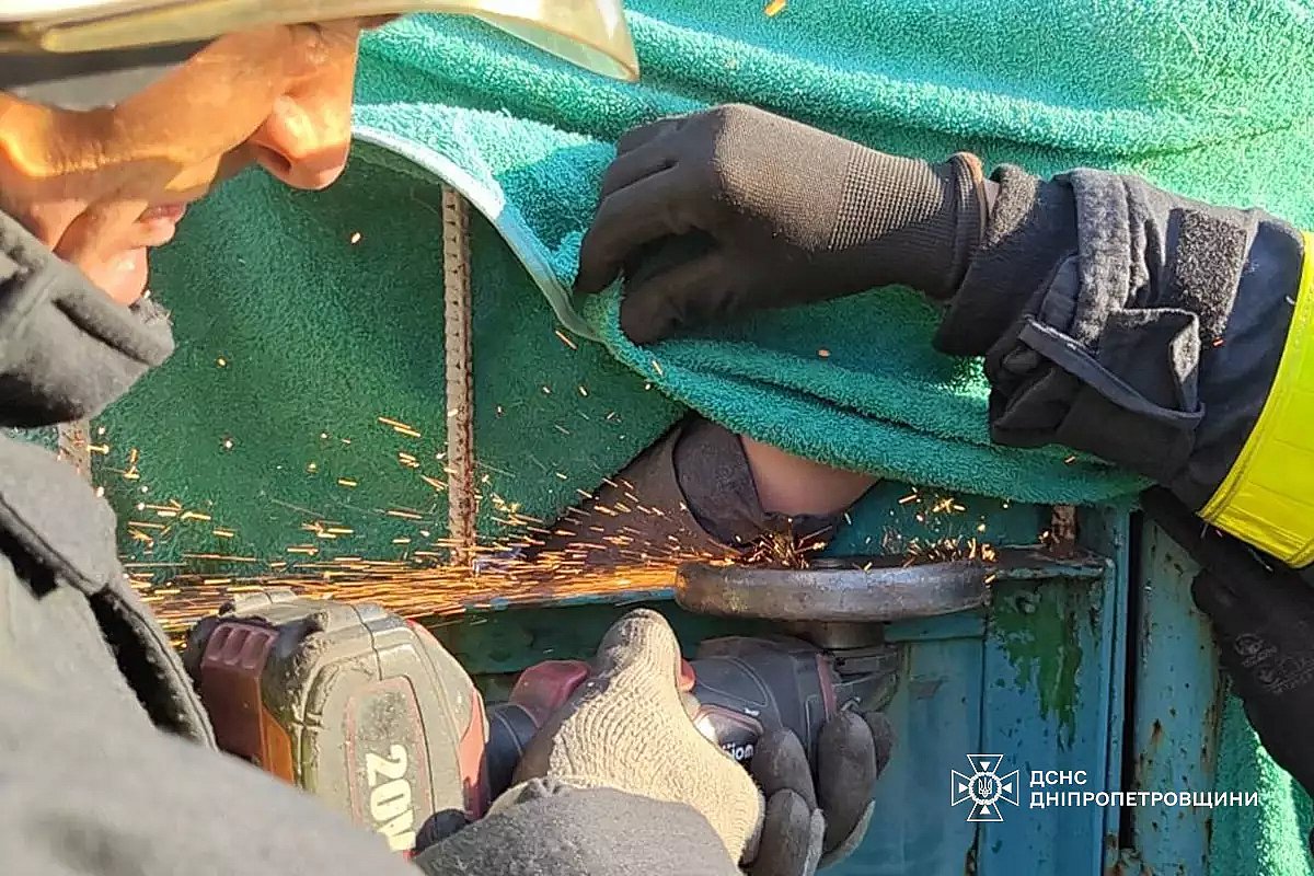 В Каменском ребенок напоролся рукой на металлический штырь забора (фото 18+) В Каменском ребенок напоролся рукой на металлический штырь забора (фото 18+)