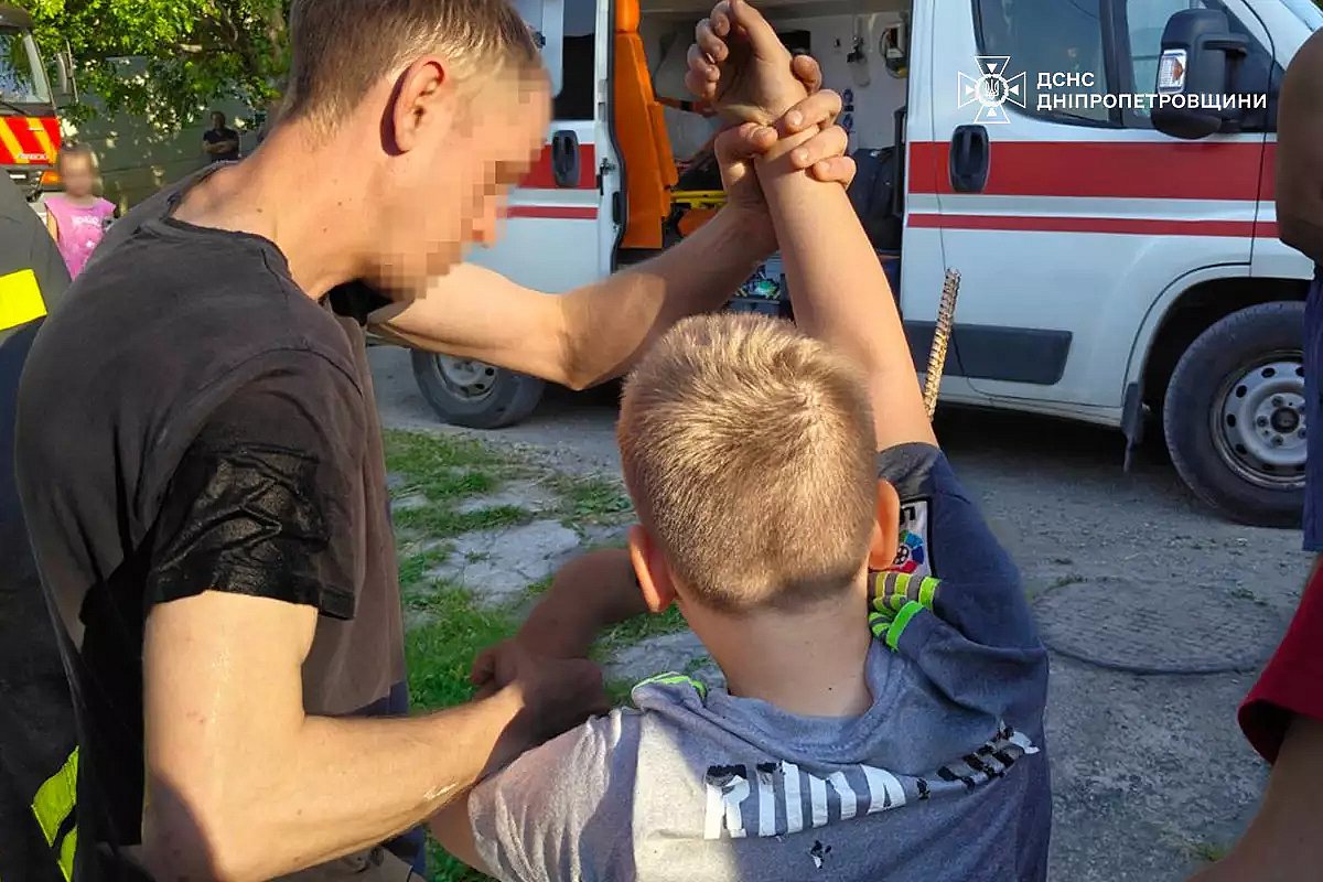 В Каменском ребенок напоролся рукой на металлический штырь забора (фото 18+) В Каменском ребенок напоролся рукой на металлический штырь забора (фото 18+)
