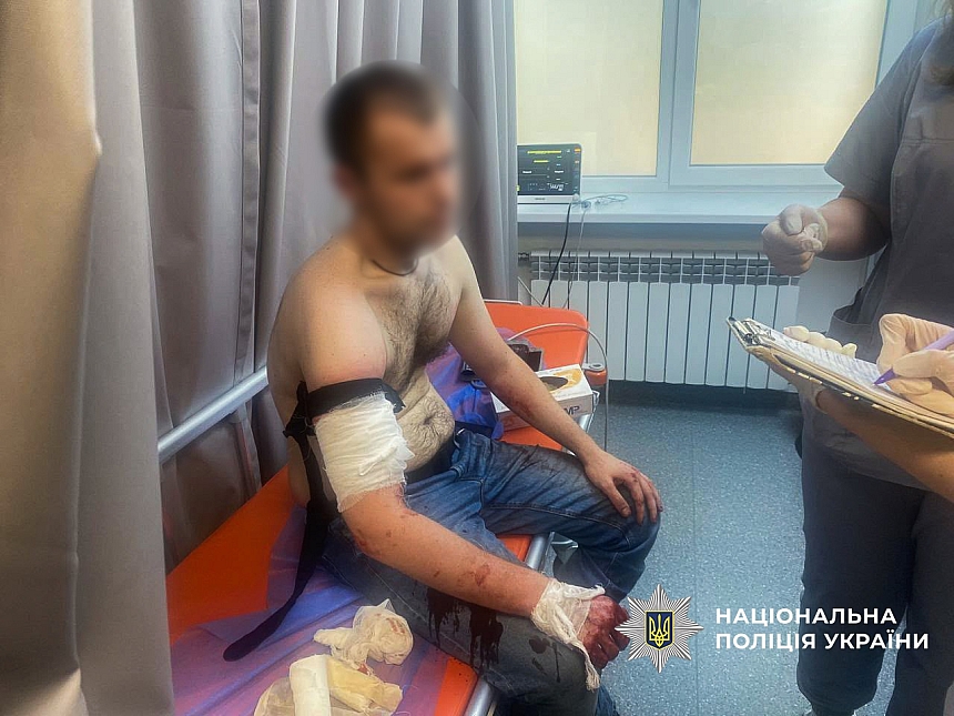 В Запорожье мужчина с ножом напал на полицейских: его застрелили В Запорожье мужчина с ножом напал на полицейских: его застрелили