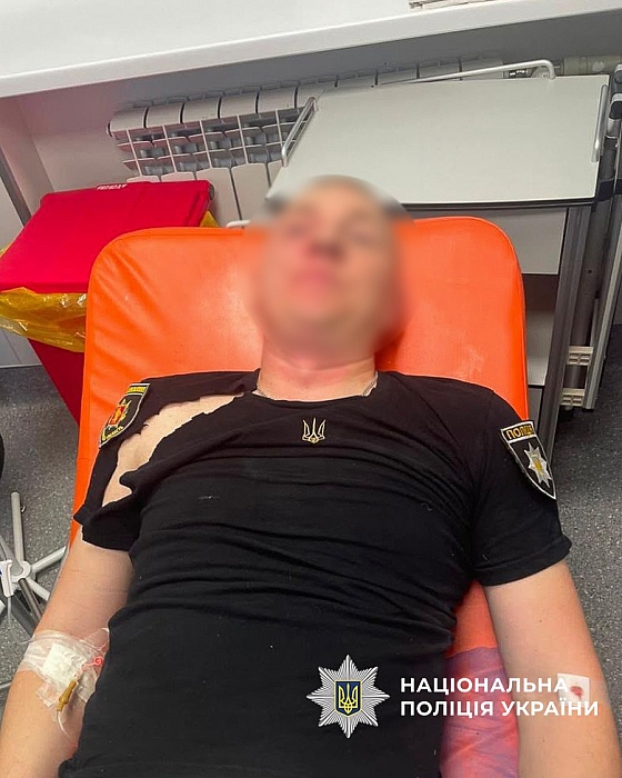 В Запорожье мужчина с ножом напал на полицейских: его застрелили В Запорожье мужчина с ножом напал на полицейских: его застрелили