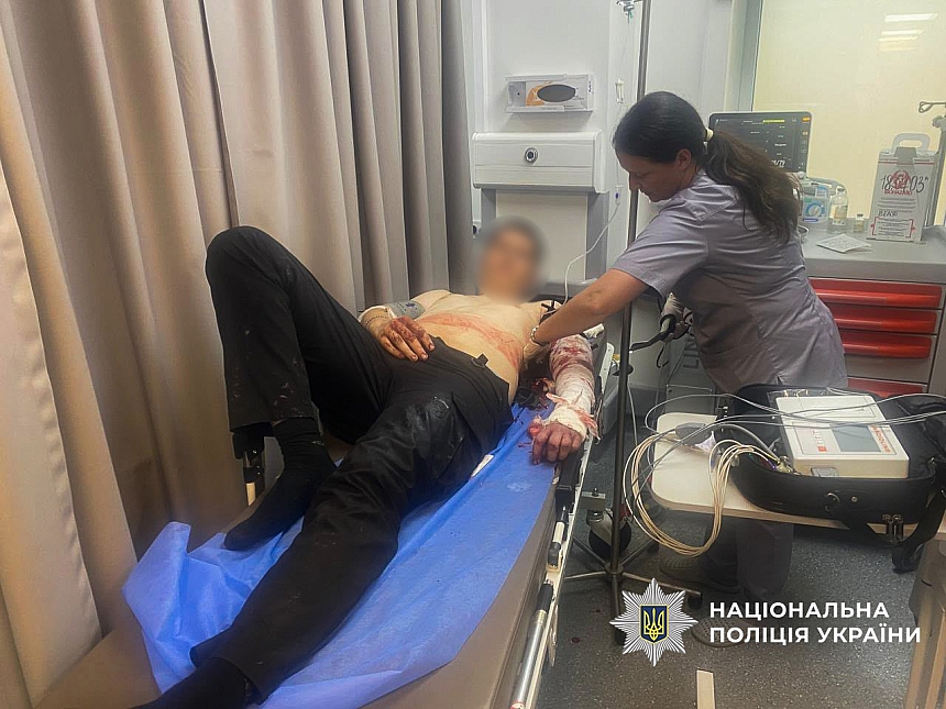 В Запорожье мужчина с ножом напал на полицейских: его застрелили В Запорожье мужчина с ножом напал на полицейских: его застрелили