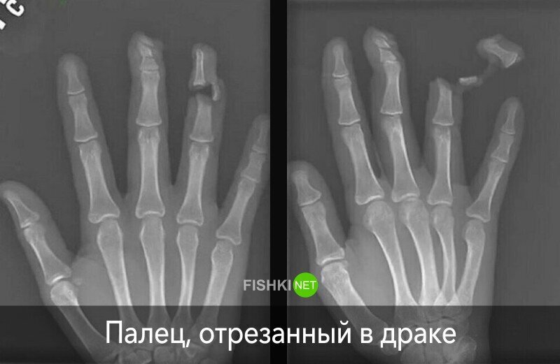  20 случаев из жизни рентгена, который видел некоторый ужас (23 фото) 