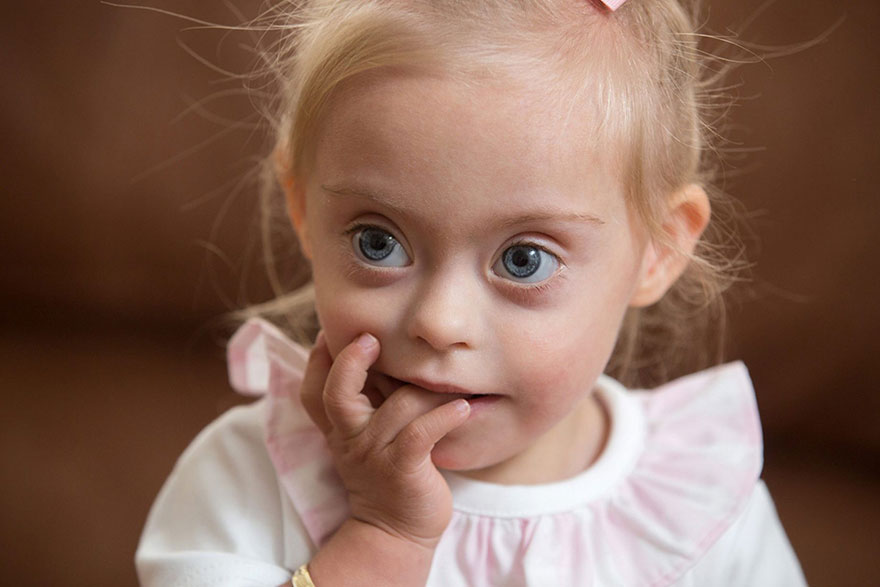 Двухлетняя девочка с синдромом Дауна стала моделью. ФОТО