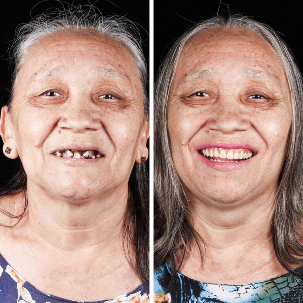 Бразильский дантист-альтруист ездит по всему миру, чтобы дарить людям новые улыбки - бесплатно!