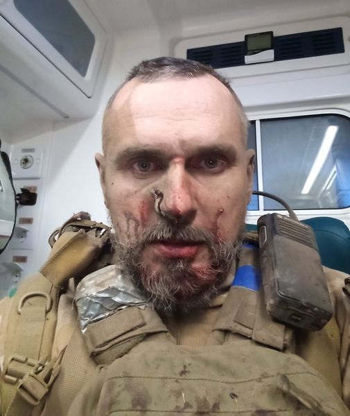 Режиссер Олег Сенцов попал под артиллерийский обстрел (ФОТО) Режиссер Олег Сенцов попал под артиллерийский обстрел (ФОТО)