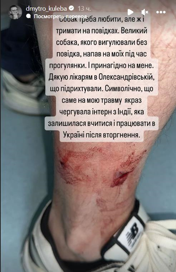 Главу МЗС покусав чужий собака Главу МЗС покусав чужий собака