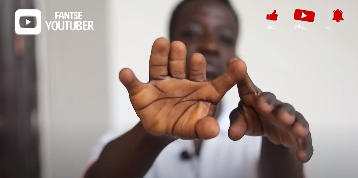 Чоловік з 12 пальцями / © скриншот з відео