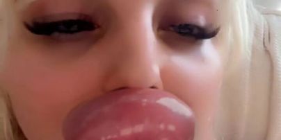 Жінка вколола в губи 30 мл філера: який вона має вигляд (фото, відео)
