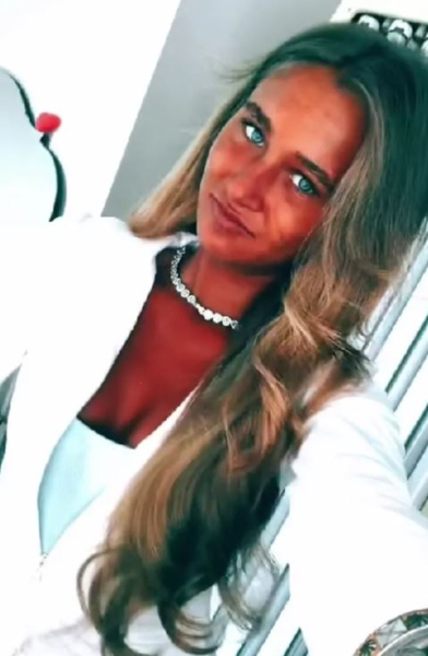 Залежна від солярію дівчина несподівано стала абсолютно чорною: що з нею сталося (фото) Залежна від солярію дівчина несподівано стала абсолютно чорною: що з нею сталося (фото)