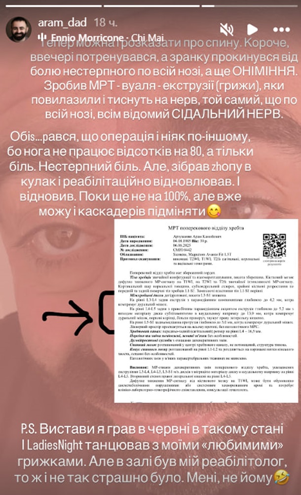 Арам Арзуманян повідомив про серйозні проблеми зі здоров’ям Арам Арзуманян повідомив про серйозні проблеми зі здоров’ям
