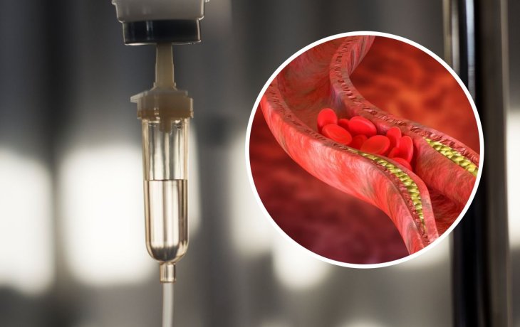 Вчені винайшли речовину, яка захистить серце після інфаркту