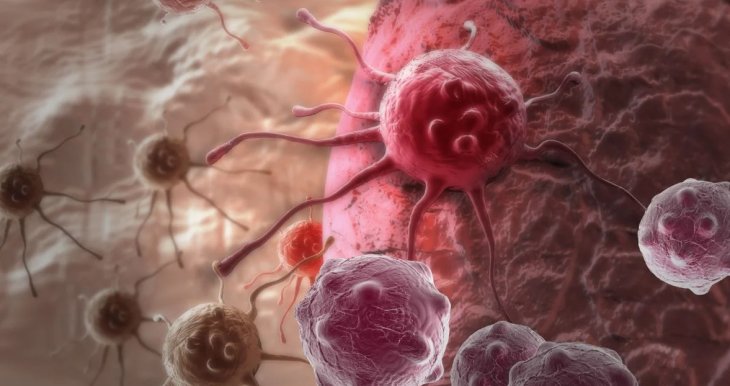 Названо 14 продуктів, які захищають від раку і усувають канцерогени