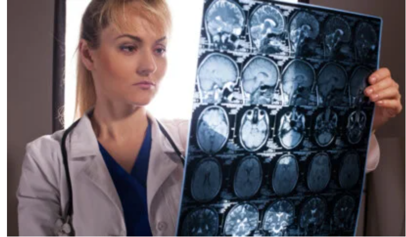 Що таке туберкульозний менінгіт і як його лікують Що таке туберкульозний менінгіт і як його лікують