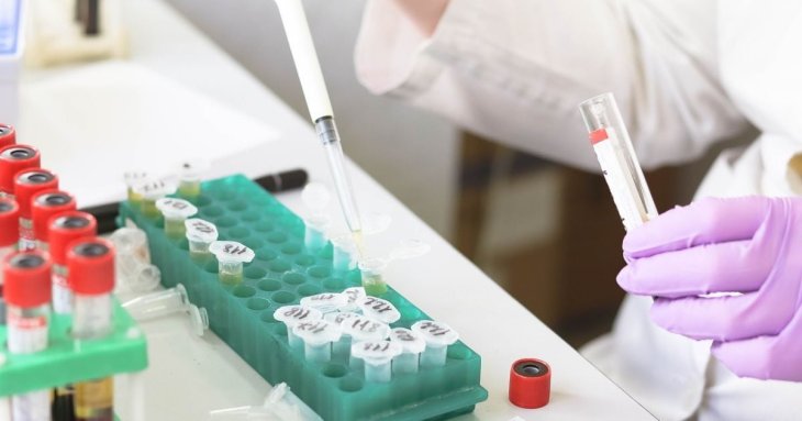 Яка група крові підвищує ризик раннього інсульту — що з’ясували генетики