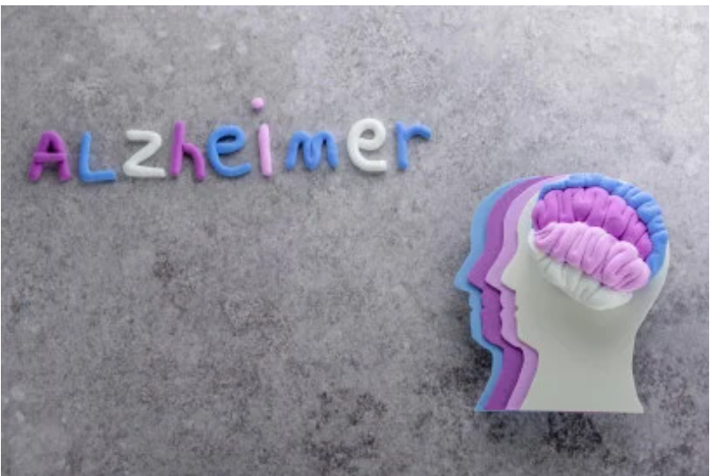 Що їсти, щоб знизити ризик хвороби Альцгеймера Що їсти, щоб знизити ризик хвороби Альцгеймера