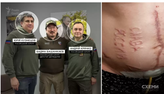 Журналісти встановили імена російських лікарів, які випалили на тілі полоненого «Слава России» Журналісти встановили імена російських лікарів, які випалили на тілі полоненого «Слава России»