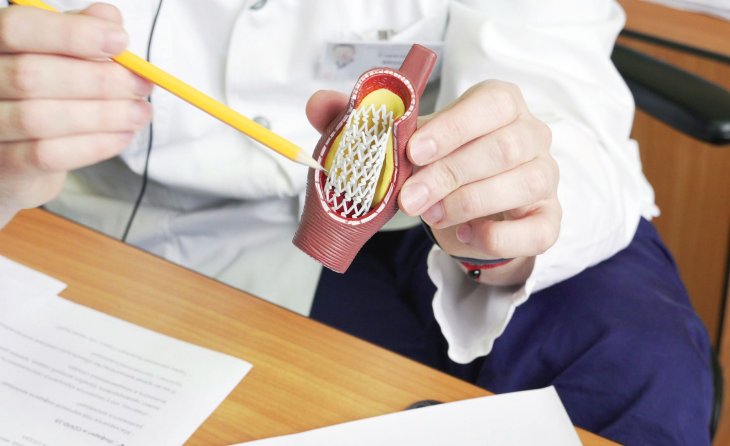 П'ять симптомів, що вказують на те, що ваші артерії страждають від жиру та холестерину