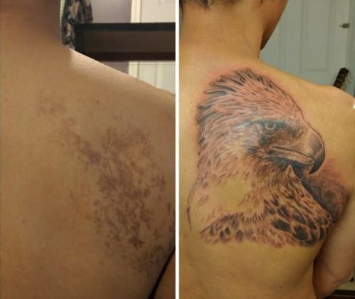 Татуировки, скрывающие родимые пятна