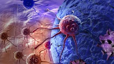 Ученые назвали фактор, который сигнализирует о развитии рака