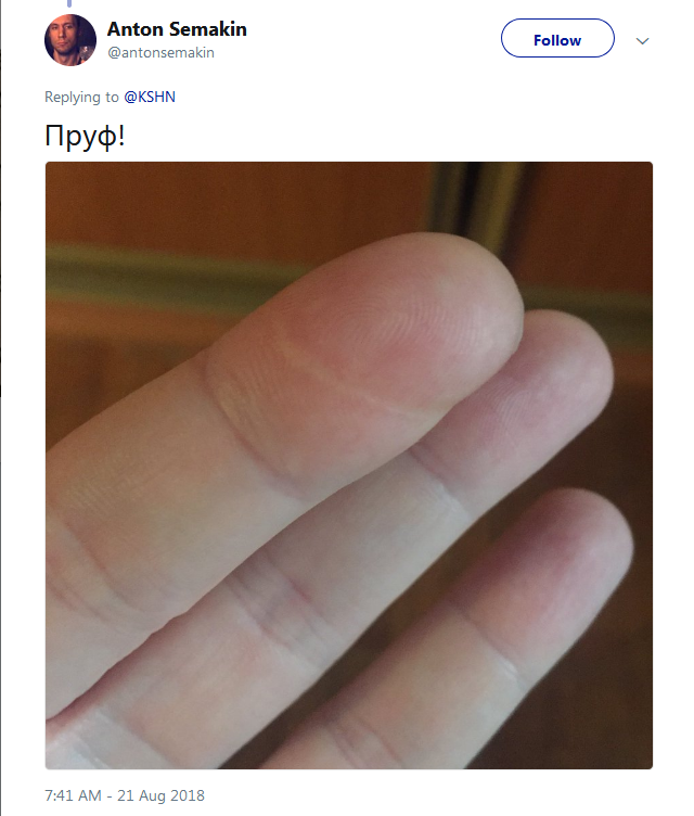 Люди вдруг осознали, что у всех них есть шрам на указательном пальце Люди вдруг осознали, что у всех них есть шрам на указательном пальце