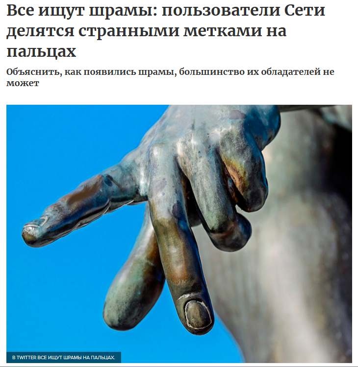 Люди вдруг осознали, что у всех них есть шрам на указательном пальце Люди вдруг осознали, что у всех них есть шрам на указательном пальце