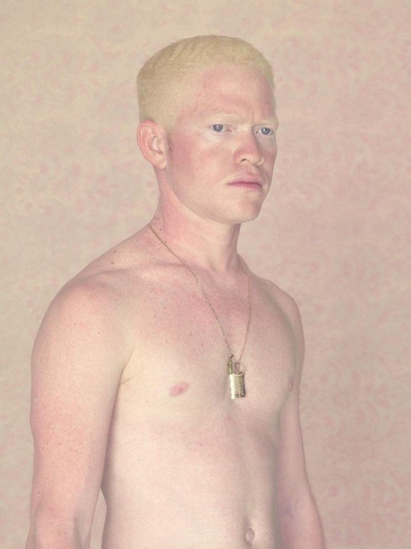 Не такие, как все: люди-альбиносы ФОТО