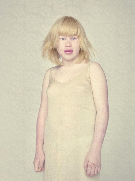 Не такие, как все: люди-альбиносы ФОТО