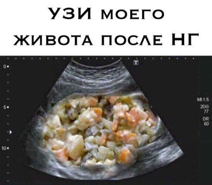 Первое января — самый короткий день в жизни: юморные новогодние мемы, фотожабы и другие приколы (ФОТО) Первое января — самый короткий день в жизни: юморные новогодние мемы, фотожабы и другие приколы (ФОТО)