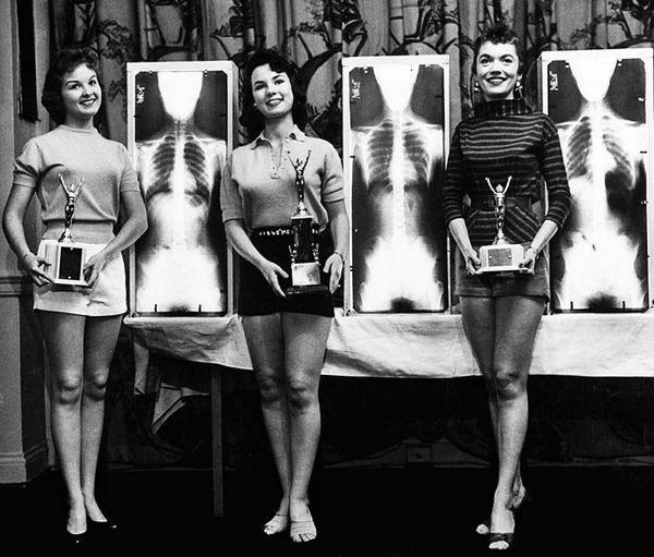 Конкурс Мисс Правильная осанка. США, 1956 г. ФОТО
