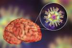 У некоторых людей, заболевших коронавирусной инфекцией, развивается неврологическая симптоматика. Ученые пытаются понять причины этого