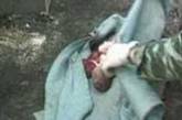 В Николаевской области на свалке нашли тело младенца