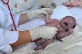 В Кировоградской области четыре младенца погибли из-за плохой воды с нитратами