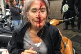 Столкновения в Каталонии: почти 40 пострадавших