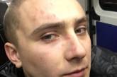 В Одессе избили активиста Стерненко, которого судят за сбыт наркотиков