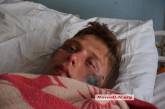 В Николаеве парень обвинил полицейских в избиении: у пострадавшего тяжелые переломы