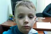 Ребенка, который ничего не помнит, нашли в подвале жилого дома в Одесской области