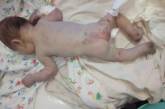 Найденный в Первомайске новорожденный в крайне тяжелом состоянии