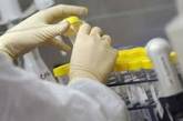 Эпидемия холеры Украине не грозит
