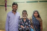В Индии мальчик из-за болезни стал "оборотнем"