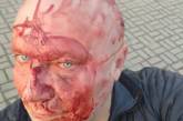В Киеве избили догхантера, «главного живодера страны» Алексея Святогора